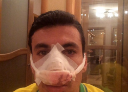 В Саранске защитнику «Кубани» Шандао сломали нос