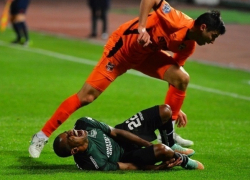 Полузащитник ФК «Краснодар» сломал ногу во время матча с «Уралом»