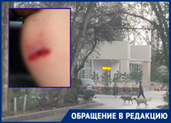 Бездомная собака вырвала кусок кожи у прохожей в Краснодаре 