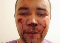 Председатель совета дома ЖК «Видный» в Краснодаре был избит двумя неизвестными 