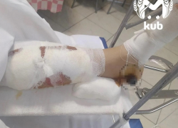 ДТП с пострадавшей школьницей в Краснодаре привлекло внимание омбудсмена России 