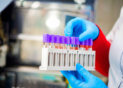 Рост продолжается: 92 новых случая заражения коронавирусом зафиксировали на Кубани