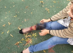 Собаки напали на врача и искусали 9-летнюю девочку на Кубани