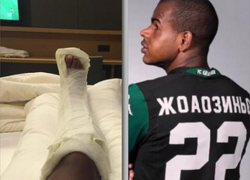 Полузащитника «Краснодара» успешно прооперировали в Германии