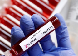 За сутки на Кубани 921 житель заболел коронавирусом