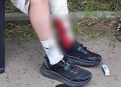 Нападение бездомной собаки на 11-летнего ребенка в Краснодаре заинтересовало Бастрыкина