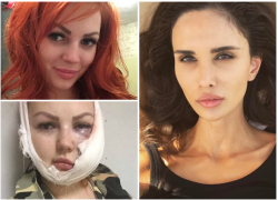 Жена игрока ФК «Краснодар» Алана Мамаева решила помочь изуродованной девушке из Апшеронска