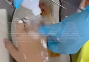 В Краснодаре 9-летний мальчик лишится пальца из-за безрассудности старшеклассницы 