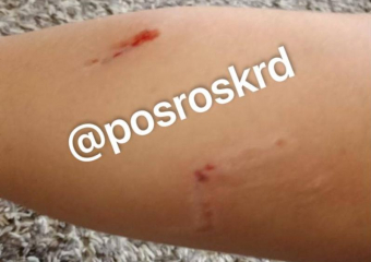 Свора бездомных собак напала на ребенка в Краснодаре 