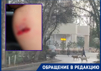 Бездомная собака вырвала кусок кожи у прохожей в Краснодаре 