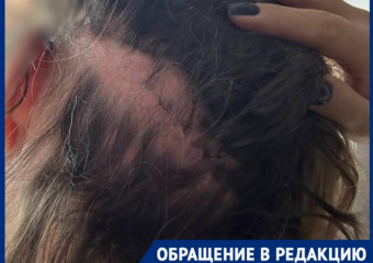 «Разбил телефон, чтобы не вызвала полицию»: сожитель подруги свирепо избил краснодарку и исчез