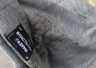 В Краснодаре выпавший из окна мальчик находится в больнице с черепно-мозговой травмой и переломом таза