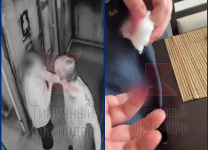 Потерей части пальца у ребенка обернулся квест в Краснодаре