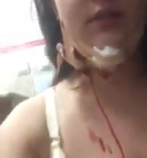 Раненая из пистолета девушка поссорилась с медиками Армавира