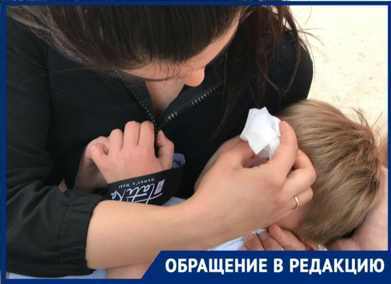 Рваную рану лица получил маленький москвич из-за велосипедистки в парке Галицкого