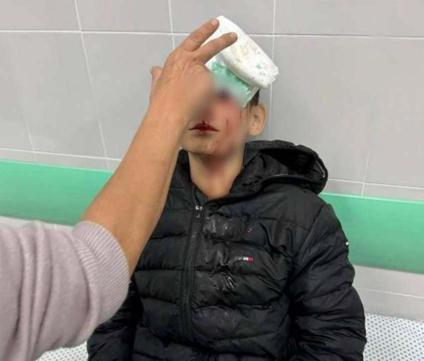 Ржавые качели разбили голову подростку в Краснодарском крае 