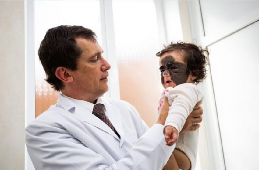 Краснодарский онколог рассказал, как снимал «маску Бэтмена» с лица трехлетней американки