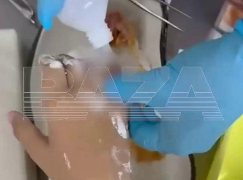 В Краснодаре 9-летний мальчик лишится пальца из-за безрассудности старшеклассницы 