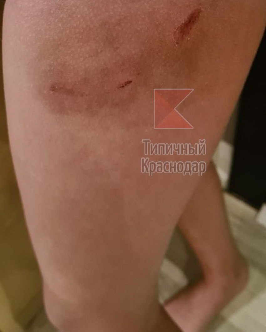 Губернатор оправдал нападение собак на девочку в школе бюрократическим безразличием чиновников Краснодара