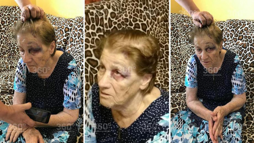 СМИ: Избили пожилую пациентку в психиатрической клинике Кубани
