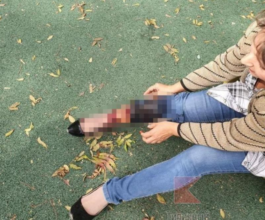 Собаки напали на врача и искусали 9-летнюю девочку на Кубани